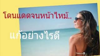 หน้าไหม้ ทำไงดี |  โดนแดดเผา