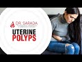 Uterine Polyps | Symptoms & Causes | Diagnosis & Treatment | Dr Sarada Mamilla