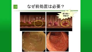 大腸がんの検査・診断と内視鏡的治療