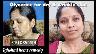 Glycerine for wrinkle skin | வறண்ட சருமம் பராமரிப்பு | முகச்சுருக்கம் நீக்க | Lakshmi home remedy