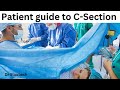 Ultimate C-Section Guide for Patients | Everything You Need to Know