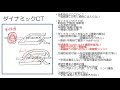 【画像診断の基本】わかりやすい造影ct ダイナミック 　理論と読み方