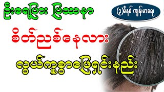 ဗောက်တွေကို လွယ်ကူစွာ ဖယ်ရှင်းနည်း၊ ဦးရေပြားပြဿနာများအတွက်