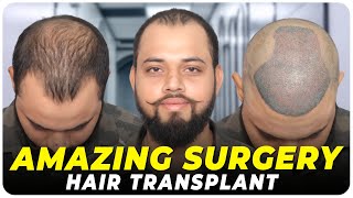 Hair Transplant in Jabalpur | Best Results & Cost of Hair Transplant in Jabalpur