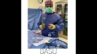 Dr. Basu explains the BodyTite process! | Basu Aesthetics + Plastic Surgery