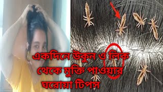 মাথার উকুন বা লিকি ১ বারেই দূর করার উপায়, উকুন দূর করার ঘরোয়া টিপস,HAIR CARE TIPS \u0026 TRICKS