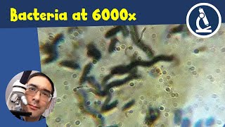 🔬 How to upgrade your microscope to get a 6000x magnification | Amateur Microscopy