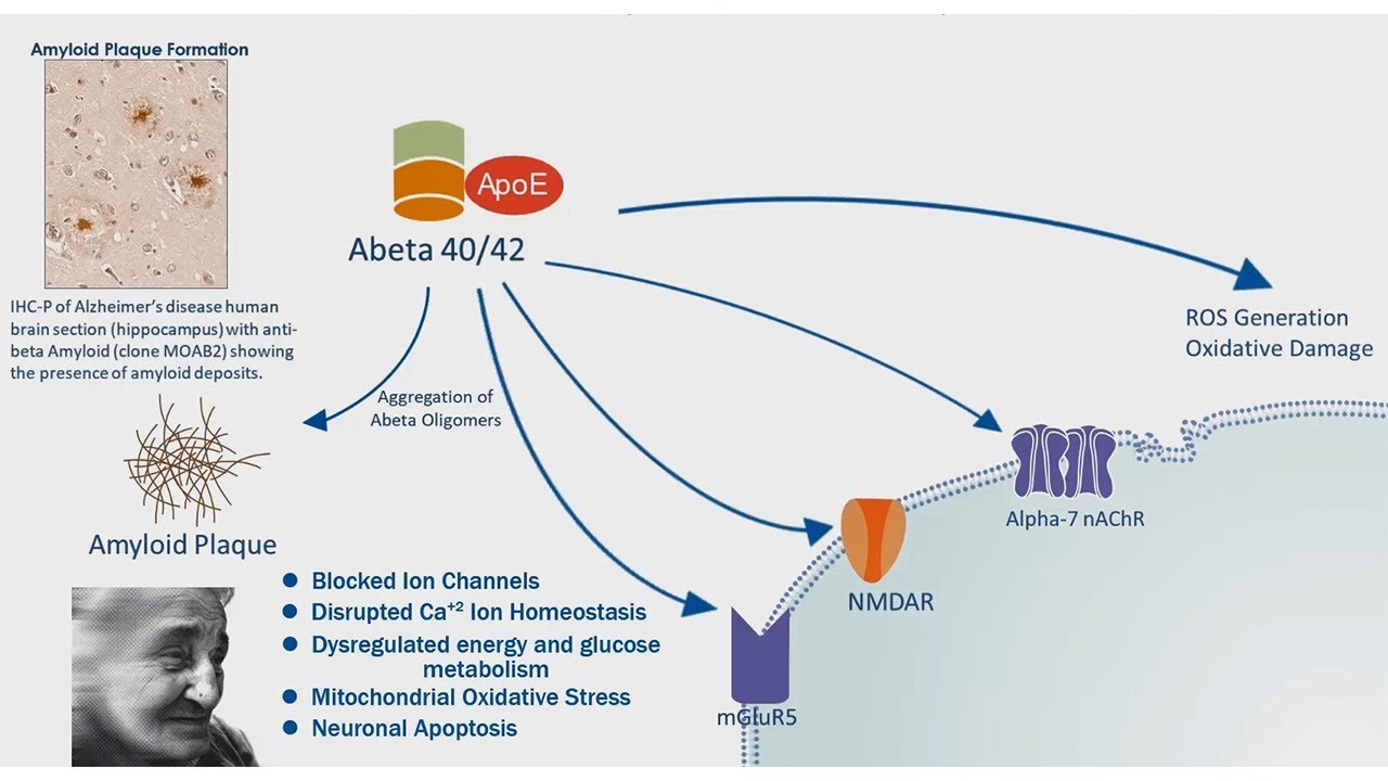 Alzheimer's Disease: APP Processing & Amyloid Plaque Formation - YouTube