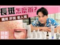 超強淡斑攻略，雀斑、曬斑、孕斑、老人斑一次搞懂！ll Kevin想得美 ll How To Remove Dark Spots On Face