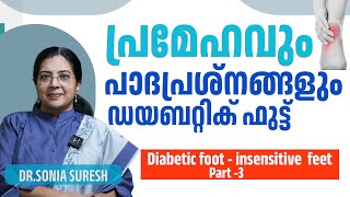 പ്രമേഹവും പാദപ്രശ്നങ്ങളും  -  ഡയബറ്റിക്  ഫുട്ട് | Diabetic foot - insensitive  feet |  PART 3