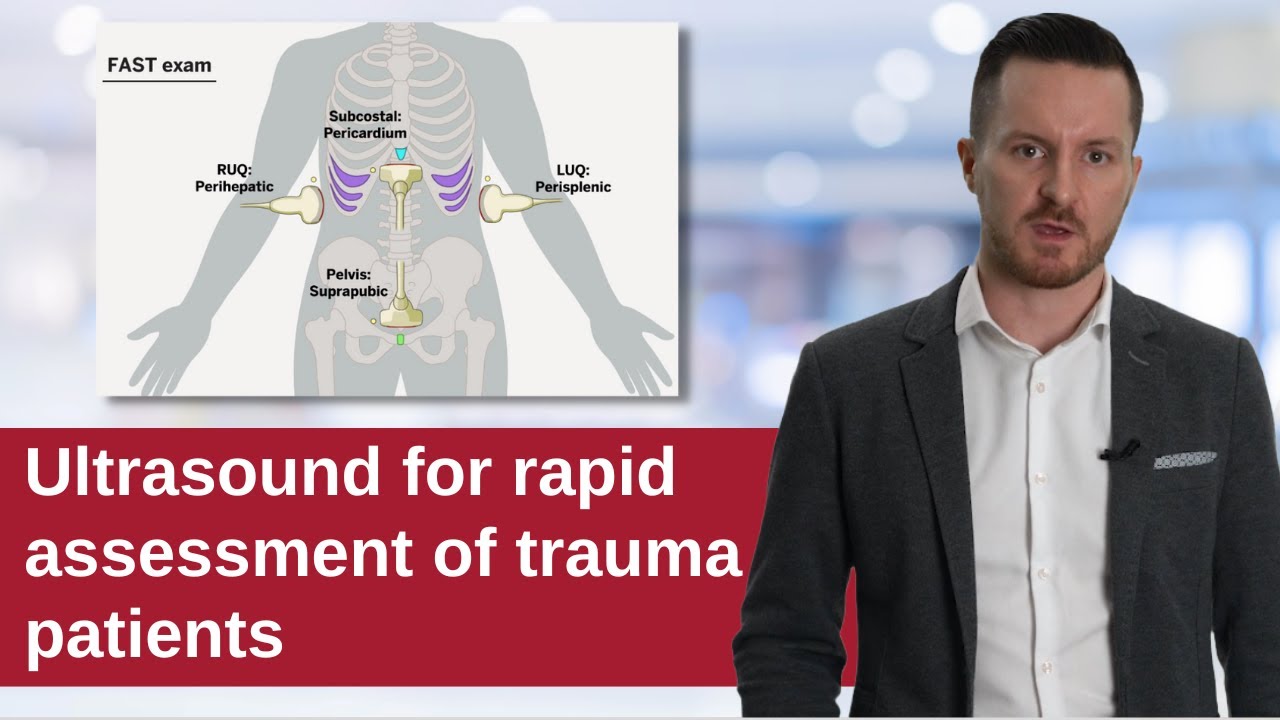 FAST Exam: Focused Assessment With Sonography In Trauma - YouTube