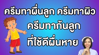 ครีมทาผื่นลูก ครีมทาผิว ครีมทาก้นลูก ที่ใช้ดีผื่นหาย | แม่โบ Nurse Kids