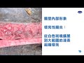 002 2021 04 14 壞死性腸炎和球蟲病：鑑別和診斷