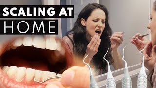 Scaling Your OWN Teeth At Home? Here Is Why It's A BAD Idea