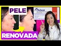 PICNOGENOL - Lightens STAINS and MELASMAS? How to use? Is it sold without a prescription?Dra. Greice