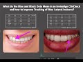 TMT, Tracking of Max Lateral Incisors and what are the Blue and Black Dots in ClinCheck