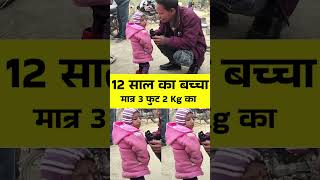 12 साल का बच्चा मात्र 3 फुट और 2 Kg का #amritkaal #news #rajaysabha #modi #bpscnotice #latestnews