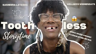 Losing My Front Tooth?! 😱 Single Denture vs Shiny Smile Veneers! Wellness Wednesdays | Kasheera