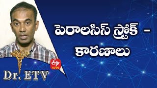 పెరాలసిస్ స్ట్రోక్  - కారణాలు| డాక్టర్ ఈటీవీ | 1st జనవరి 2022 |  ఈటీవీ  లైఫ్