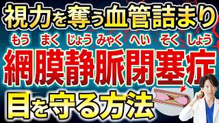 【網膜静脈閉塞症徹底解説】BRVOとCRVOの違いを明確化！抗VEGF注射（アイリーア・ルセンティス・バビースモ）やレーザー治療効果を詳述し視力回復を目指す最新対策を詳解します！知識を深める必見情報！