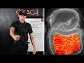 abdominal quadrants explained simply for emt nremt review emt lectures