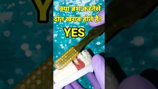 ब्रश करने का सही तरीका। right technique for brushing teeth। how to do brush on teeth બ્રશ દાંત ઉપર