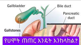 የሀሞት ጠር ምንድነዉ? እንዴት እንከላከል?|how to prevent gallbladder stone #Ethiopia #health