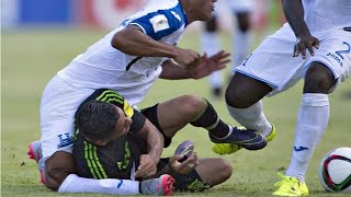 Escalofriante, impactante lesión de #Luis Garrido en la eliminatoria rumbo a #Rusia  🇭🇳HOND🆚MEX🇲