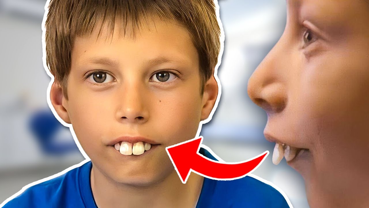 Worst Buck Teeth