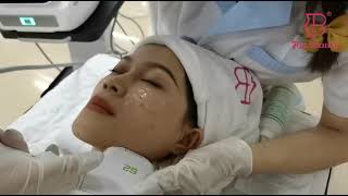 7D HIFU / Vmax HIFU RF  | Skin Tightening Facial Treatment