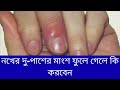 হাতের নখের সমস্যা বা ফাঙ্গাশ হলে করনিয় || Health Tips Bangla