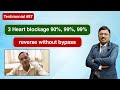 Testimonial #87: 3 Heart Blockage 90%, 99%, 99% Reverse Without Bypass | Dr. Bimal Chhajer | SAAOL