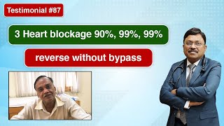 Testimonial #87: 3 Heart Blockage 90%, 99%, 99% Reverse Without Bypass | Dr. Bimal Chhajer | SAAOL