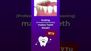 MYTHS \u0026 FACTS about Teeth Scaling | Dental Care | Molar Bear Dental Studio