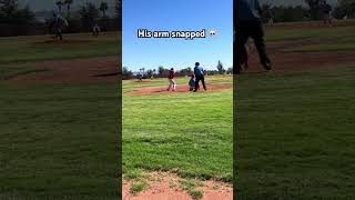 Pitcher S Arm Snaps Shorts Baseball Pitching