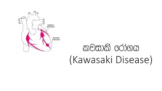 06. කවසාකි රෝගය (Kawasaki Disease) ගැන ඔබ දැන ගත යුතු දේ!