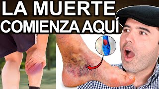 VENAS EN LOS PIES? ALERTA! - Enfermedades Que Las Causan Y Soluciones