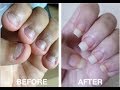 How To Stop Biting Your Nails.... FOR GOOD How To Stop Biting Your Nails.... FOR GOOD