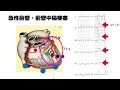 【循環器】5分でわかる「急性心筋梗塞の心電図st上昇3パターン」