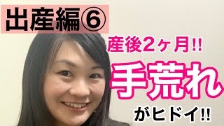 【実践！産後の養生6】産後2ヶ月、手荒れの悩み【漢方・薬膳】