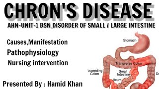 Chron's disease in Urdu||causes  manifestation nursing intervention|| Ahn Unit 1 GI disorder