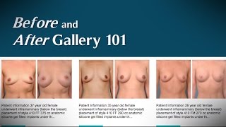 Before & After pictures in plastic surgery - PSC Roundtable - Ep.6