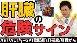 【がん専門医が語る】肝臓の危険サインを見逃すな！酒を飲まないのになる肝臓がんと健康診断で絶対にチェックしておきたいポイント #肝臓がん #肝硬変 #脂肪肝