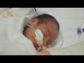 体からミルクの香り！癒されます ⋈◍＞◡＜◍ 。✧♡【day 12】低出生体重児の成長記録 low birth weight infant