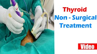Non - Surgical Treatment for Thyroid | Citi Vascular Hospital | #nonsurgicaltreatments #thyroid