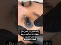 ازاله وشم العين مع صالون مسيو مانو للحجز 01205521948