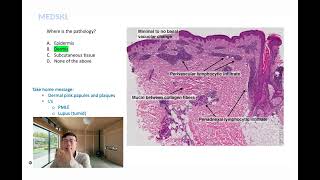 Dermis Diagnosis - Module: By Harry Liu MD - MEDSKL