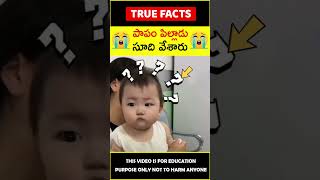 Doctor helps baby #satisfying 😭పాపం పిల్లాడు😭 #amazingfacts #truefacts #shorts