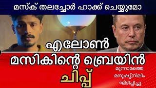 എലൺ മസ്കിന്റെ ബ്രെയിൻ ചിപ്പ്‌ | Elon Musk Brain Chip | Nuralink | Fact \u0026 Future |@Mybeats65