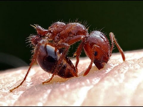 DIY Fire Ant Bite & Sting Home Remedy Treatment DIY Fire Ant Bite & Sting Home Remedy Treatment